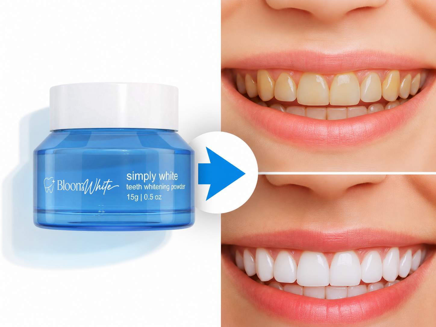 Bloom White Whitening Powder Results